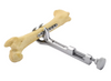Lowman Bone Clamp